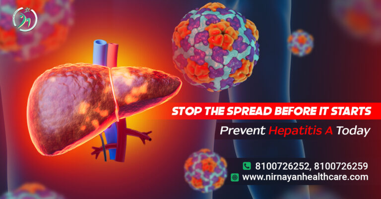 Symptoms of Hepatitis A