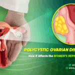PCOD (Polycystic Ovarian Disease) – Symptoms, Causes, & Treatments Causes & Symptoms of PCOD