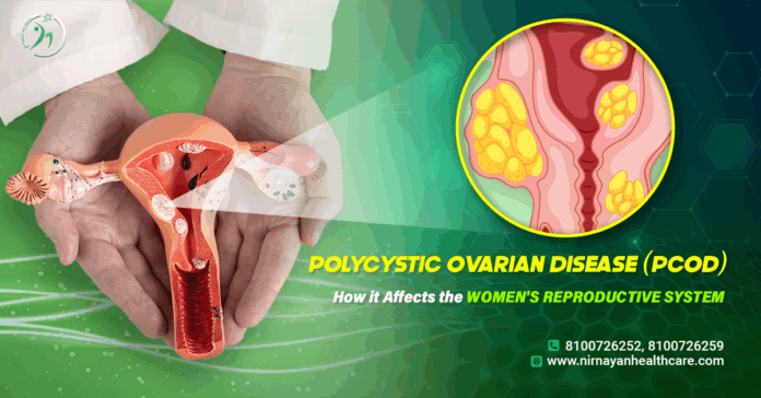 Causes & Symptoms of PCOD